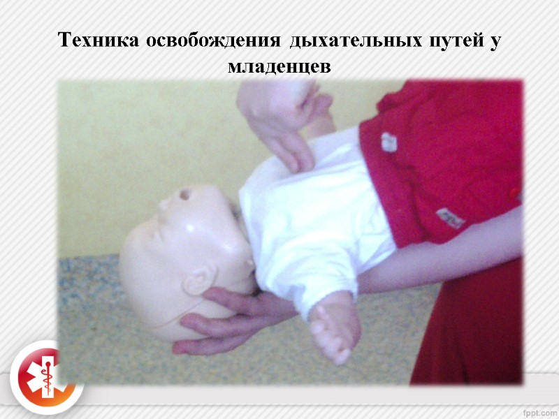 Техника освобождения дыхательных путей у младенцев